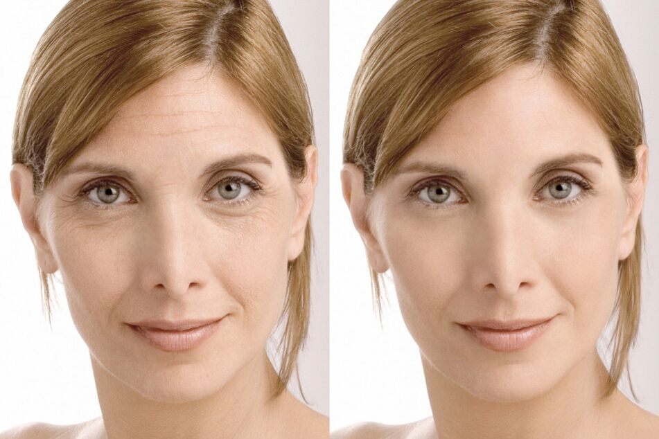 User experience before and after using Milana intenskin cream